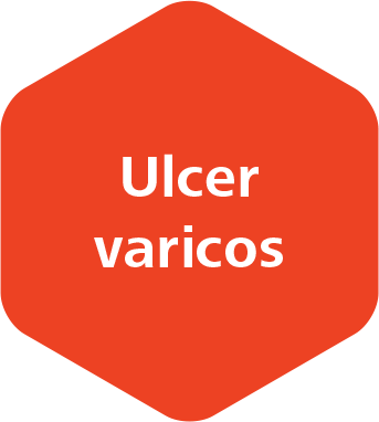 Ulcer varicos 1